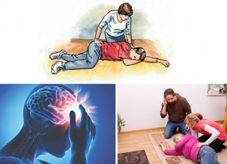 Sai lầm chết người trong cấp cứu người bệnh đột quỵ